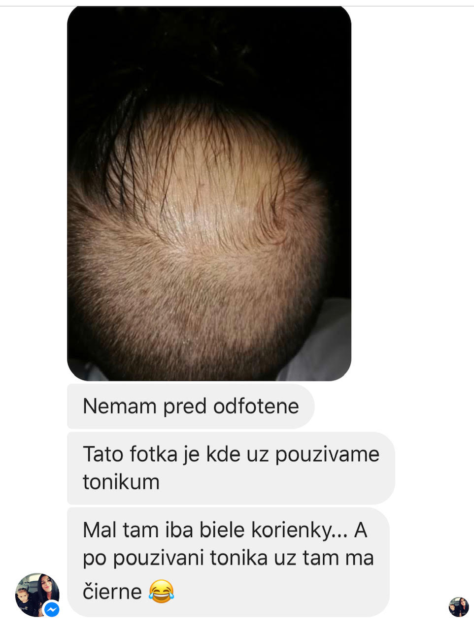 Tonikum pre rýchly rast vlasov